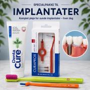 Implantater - Alt hvad du har brug for