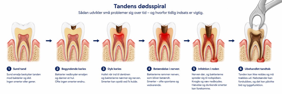 Dødsspiralen