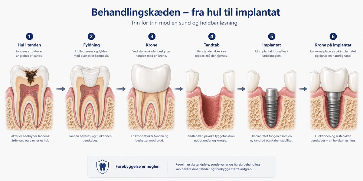 Fra hul til Implantat