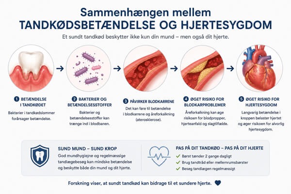 Tandkødsbetændelse og hjertesygdom