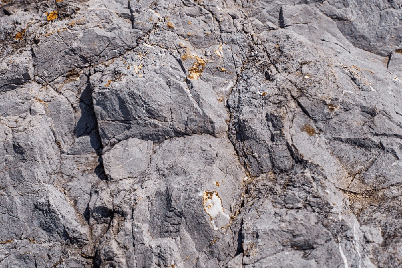 Pas på dine tænder ikke bliver til sten
